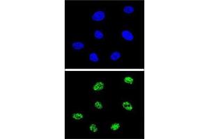 Image no. 2 for anti-Tumor Protein P73 (TP73) (AA 288-317) antibody (ABIN3029400)