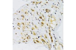 Image no. 1 for anti-Ribosomal Protein L13 (RPL13) antibody (ABIN6147109)