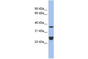 Image no. 1 for anti-Ornithine Decarboxylase Antizyme 2 (OAZ2) (Middle Region) antibody (ABIN2786667)