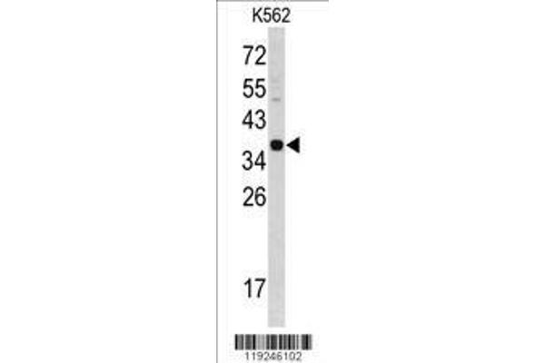 anti-Cathepsin E (CTSE) (AA 157-187) antibody