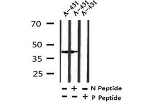 Image no. 1 for anti-TAR DNA Binding Protein (TARDBP) (pSer409) antibody (ABIN6270142)