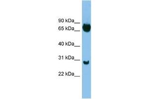 Image no. 1 for anti-SRY (Sex Determining Region Y)-Box 13 (SOX13) (Middle Region) antibody (ABIN2778090)