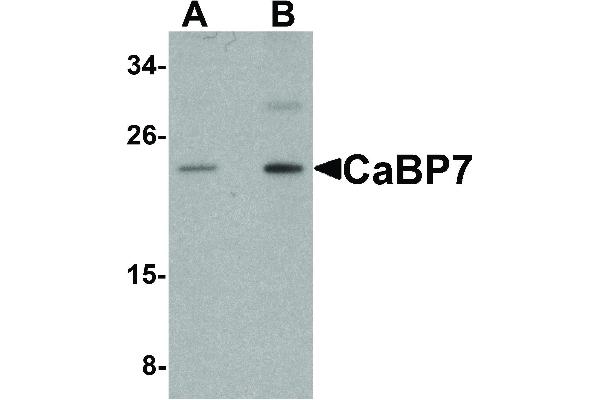 CABP7 antibody  (N-Term)