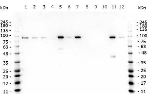 Anti Beta Catenin Anticorps C Term Produit Abin