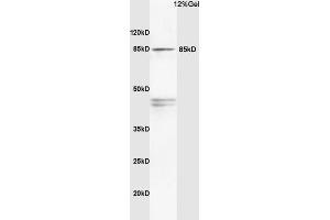 Image no. 3 for anti-Phosphoinositide 3 Kinase, p85 alpha (PI3K p85a) (AA 501-600) antibody (ABIN725405)