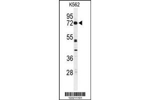 Western Blotting (WB) image for anti-Cyclic Nucleotide Gated Channel alpha 2 (CNGA2) antibody (ABIN2158296)