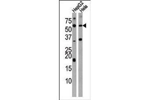 Image no. 1 for anti-Activin Receptor Type 1C (ACVR1C) (AA 33-62), (N-Term) antibody (ABIN391157)