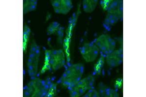 SLC12A3 antibody  (AA 74-95)