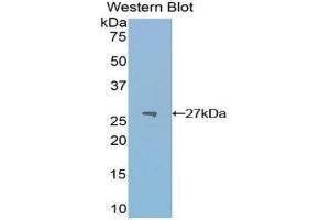 Image no. 1 for anti-Pyruvate Kinase M2 (PKM2) (AA 324-531) antibody (ABIN1860244)