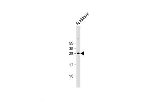 Image no. 3 for anti-Erythropoietin (EPO) (AA 20-48), (N-Term) antibody (ABIN5533604)
