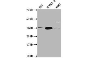 Western Blot Positive WB detected in: U87 whole cell lysate, NTERA-2 whole cell lysate, K562 whole cell lysate All lanes: CBY1 antibody at 1:2000 Secondary Goat polyclonal to rabbit IgG at 1/50000 dilution Predicted band size: 15 kDa Observed band size: 35 kDa