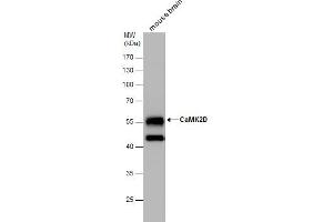 Image no. 4 for anti-Calcium/calmodulin-Dependent Protein Kinase II delta (CAMK2D) (Center) antibody (ABIN2856806)