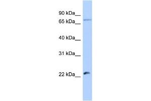 Image no. 1 for anti-Heat Shock Transcription Factor, Y Linked 2 (HSFY2) (Middle Region) antibody (ABIN2784596)