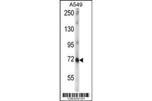 Image no. 1 for anti-Zinc Finger Protein 429 (ZNF429) (AA 646-674), (C-Term) antibody (ABIN656858)