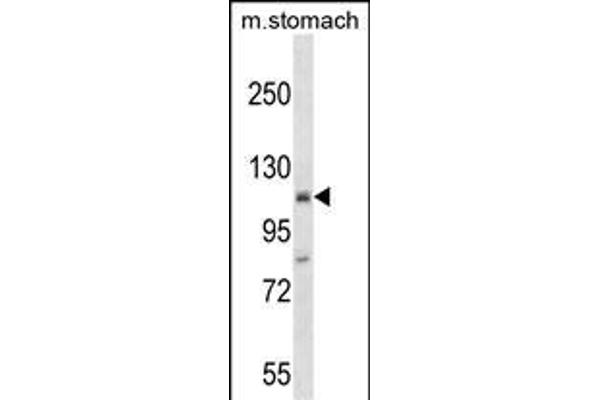 ST18 anticorps  (N-Term)