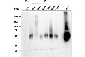 anti-Tumor Necrosis Factor Receptor Superfamily, Member 17 (TNFRSF17) (AA 1-54) antibody
