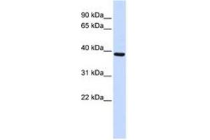 Image no. 1 for anti-F-Box Protein 24 (FBXO24) (AA 304-353) antibody (ABIN6743158)