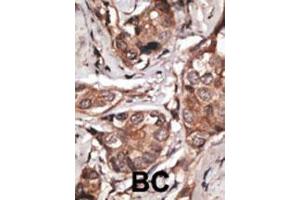Image no. 1 for anti-HtrA Serine Peptidase 1 (HTRA1) (AA 381-412), (C-Term) antibody (ABIN388128)
