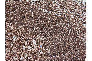 Image no. 4 for anti-Mitogen-Activated Protein Kinase 4 (MAPK4) antibody (ABIN1499312)