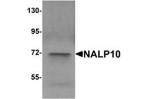Image no. 1 for anti-NLR Family, Pyrin Domain Containing 10 (NLRP10) (N-Term) antibody (ABIN783715)