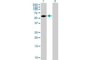Image no. 1 for anti-Gardner-Rasheed Feline Sarcoma Viral (V-Fgr) Oncogene Homolog (FGR) (AA 1-529) antibody (ABIN515643)