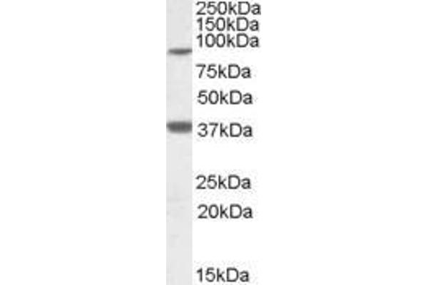 LASS1 antibody  (Internal Region)