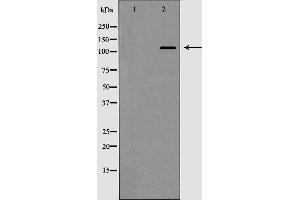 Image no. 1 for anti-Histone Deacetylase 5 (HDAC5) antibody (ABIN6262182)