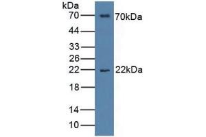 Image no. 5 for Interleukin 1 Receptor Accessory Protein (IL1RAP) ELISA Kit (ABIN6730975)