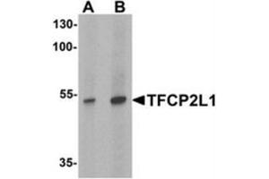 Image no. 2 for anti-Transcription Factor CP2-Like 1 (TFCP2L1) (N-Term) antibody (ABIN1450148)
