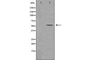 Image no. 1 for anti-Macrophage Scavenger Receptor 1 (MSR1) (N-Term) antibody (ABIN6263400)