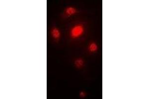 Image no. 1 for anti-Origin Recognition Complex, Subunit 6 (ORC6) antibody (ABIN3197748)