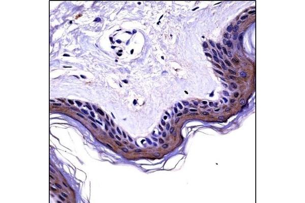 NCK2 antibody  (N-Term)