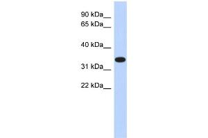 Image no. 1 for anti-Actin-Related Protein T1 (ACTRT1) (Middle Region) antibody (ABIN2784995)