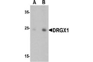 Image no. 1 for anti-Dorsal Root Ganglia Homeobox (DRGX) (C-Term) antibody (ABIN1450061)