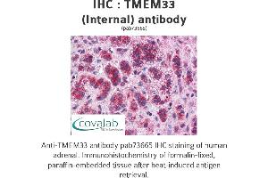 Image no. 1 for anti-Transmembrane Protein 33 (TMEM33) (Internal Region) antibody (ABIN1740155)