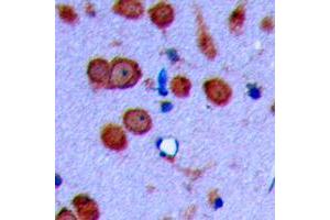 Image no. 1 for anti-Cadherin 19 (CDH19) (Center) antibody (ABIN2705641)