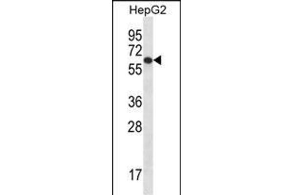 TBC1D22A antibody  (C-Term)