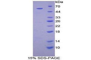 Image no. 1 for Transglutaminase 1, Keratinocyte (TGM1) (AA 562-800) protein (His tag,GST tag) (ABIN1877752)