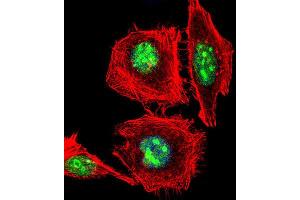 Image no. 2 for anti-Empty Spiracles Homeobox 1 (EMX1) antibody (ABIN3003987)