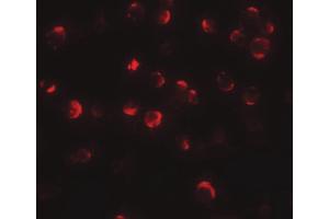 Image no. 2 for anti-Maelstrom Spermatogenic Transposon Silencer (MAEL) (C-Term) antibody (ABIN6657327)