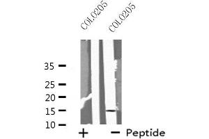 Image no. 1 for anti-Microsomal Glutathione S-Transferase 2 (MGST2) (Internal Region) antibody (ABIN6258287)