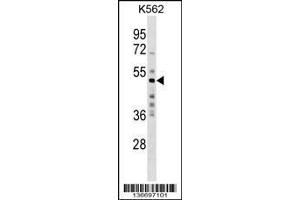 Image no. 1 for anti-Makorin Ring Finger Protein 2 (MKRN2) (AA 78-106), (N-Term) antibody (ABIN1539600)