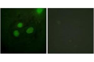 Image no. 2 for anti-Replication Protein A2, 32kDa (RPA2) (AA 10-59) antibody (ABIN1532646)