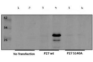 Image no. 1 for anti-Cyclin-Dependent Kinase Inhibitor 1B (p27, Kip1) (CDKN1B) (Internal Region), (pSer140) antibody (ABIN5596806)