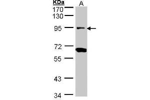 Image no. 1 for anti-Periostin (POSTN) (C-Term) antibody (ABIN2854805)