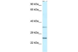 Image no. 1 for anti-Protein Phosphatase 1, Regulatory (Inhibitor) Subunit 2 (PPP1R2) (N-Term) antibody (ABIN926729)