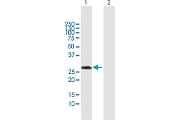 anti-Variable Charge, X-Linked 3A (VCX3A) (AA 1-166) antibody