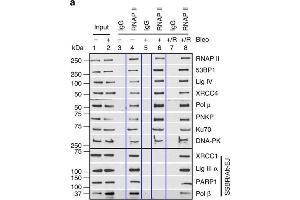 Image no. 15 for anti-Poly (ADP-Ribose) Polymerase 1 (PARP1) (Center) antibody (ABIN2854798)