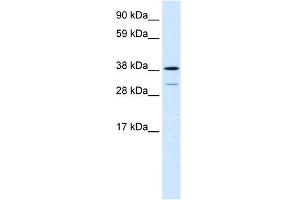 Image no. 1 for anti-Vacuolar Protein Sorting 72 Homolog (S. Cerevisiae) (VPS72) (Middle Region) antibody (ABIN2778249)