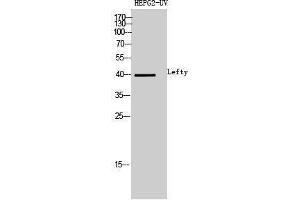 LEFTY1 antibody  (Internal Region)